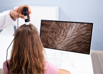 Hairfall management/ GFC / PRP